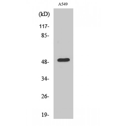 Dynactin 2 / Dynamitin Antibody - Western blot of Dynactin 2 antibody
