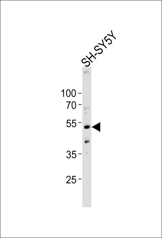 Dynactin 2 / Dynamitin Antibody - Western blot of lysate from SH-SY5Y cell line, using DCTN2 Antibody. Antibody was diluted at 1:1000 at each lane. A goat anti-rabbit IgG H&L (HRP) at 1:5000 dilution was used as the secondary antibody. Lysate at 35ug per lane.