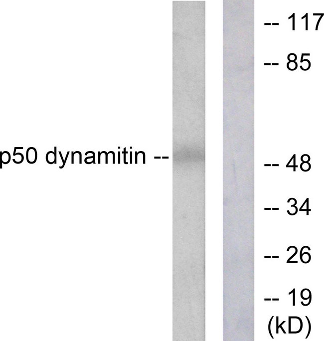 Dynactin 2 / Dynamitin Antibody - Western blot analysis of lysates from A549 cells, using p50 Dynamitin Antibody. The lane on the right is blocked with the synthesized peptide.