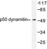 Dynactin 2 / Dynamitin Antibody - Western blot of p50 Dynamitin (L371) pAb in extracts from A549 cells.