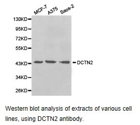 Dynactin 2 / Dynamitin Antibody - Western blot.