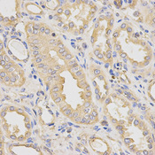 Dynactin 2 / Dynamitin Antibody - Immunohistochemistry of paraffin-embedded human kidney tissue.