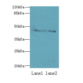 Dynactin 2 / Dynamitin Antibody - Western blot. All lanes: DCTN2 antibody at 8 ug/ml. Lane 1: Mouse brain tissue. Lane 2: MCF7 whole cell lysate. Secondary Goat polyclonal to Rabbit IgG at 1:10000 dilution. Predicted band size: 44 kDa. Observed band size: 44 kDa.