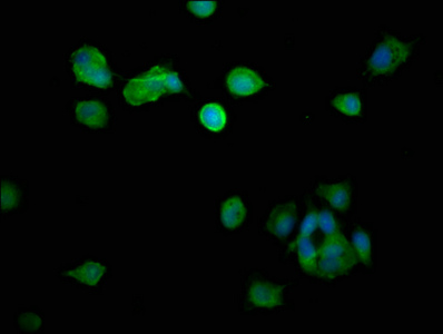 Dynactin 2 / Dynamitin Antibody - Immunofluorescence staining of MCF-7 cells with DCTN2 Antibody at 1:266, counter-stained with DAPI. The cells were fixed in 4% formaldehyde, permeabilized using 0.2% Triton X-100 and blocked in 10% normal Goat Serum. The cells were then incubated with the antibody overnight at 4°C. The secondary antibody was Alexa Fluor 488-congugated AffiniPure Goat Anti-Rabbit IgG(H+L).