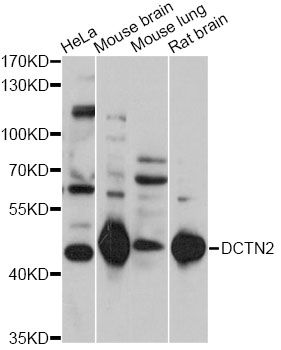 Dynactin 2 / Dynamitin Antibody - Western blot analysis of extracts of various cell lines, using DCTN2 antibody at 1:1000 dilution. The secondary antibody used was an HRP Goat Anti-Rabbit IgG (H+L) at 1:10000 dilution. Lysates were loaded 25ug per lane and 3% nonfat dry milk in TBST was used for blocking. An ECL Kit was used for detection and the exposure time was 30s.