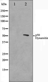 Dynactin 2 / Dynamitin Antibody - Western blot analysis on A549 cell lysates using p50 Dynamitin antibody. The lane on the left is treated with the antigen-specific peptide.