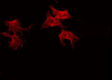 Dynactin 2 / Dynamitin Antibody - Staining A549 cells by IF/ICC. The samples were fixed with PFA and permeabilized in 0.1% Triton X-100, then blocked in 10% serum for 45 min at 25°C. The primary antibody was diluted at 1:200 and incubated with the sample for 1 hour at 37°C. An Alexa Fluor 594 conjugated goat anti-rabbit IgG (H+L) Ab, diluted at 1/600, was used as the secondary antibody.