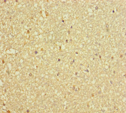 Dynactin 3 / DCTN3 Antibody - Immunohistochemistry of paraffin-embedded human brain tissue using DCTN3 Antibody at dilution of 1:100