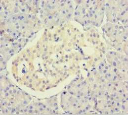 Dynactin 3 / DCTN3 Antibody - Immunohistochemistry of paraffin-embedded human pancreatic tissue using DCTN3 Antibody at dilution of 1:100