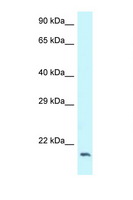 Dynactin 3 / DCTN3 Antibody - DCTN3 antibody Western blot of 293T Cell lysate. Antibody concentration 1 ug/ml.  This image was taken for the unconjugated form of this product. Other forms have not been tested.