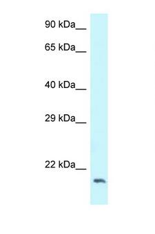 Dynactin 3 / DCTN3 Antibody - DCTN3 antibody Western blot of 293T Cell lysate. Antibody concentration 1 ug/ml.  This image was taken for the unconjugated form of this product. Other forms have not been tested.