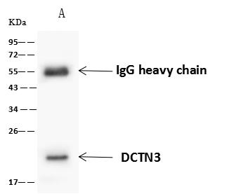 Dynactin 3 / DCTN3 Antibody - DCTN3 was immunoprecipitated using: Lane A: 0.5 mg HeLa Whole Cell Lysate. 4 uL anti-DCTN3 rabbit polyclonal antibody and 60 ug of Immunomagnetic beads Protein A/G. Primary antibody: Anti-DCTN3 rabbit polyclonal antibody, at 1:100 dilution. Secondary antibody: Goat Anti-Rabbit IgG (H+L)/HRP at 1/10000 dilution. Developed using the ECL technique. Performed under reducing conditions. Predicted band size: 21 kDa. Observed band size: 21 kDa.