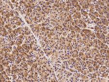 Dynactin 3 / DCTN3 Antibody - Immunochemical staining of human DCTN3 in human pancreas with rabbit polyclonal antibody at 1:100 dilution, formalin-fixed paraffin embedded sections.