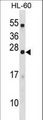 DYNAP Antibody - C18orf26 Antibody western blot of HL-60 cell line lysates (35 ug/lane). The C18orf26 antibody detected the C18orf26 protein (arrow).