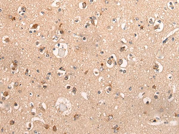 DYNAP Antibody - Immunohistochemistry of paraffin-embedded Human brain tissue  using DYNAP Polyclonal Antibody at dilution of 1:50(×200)