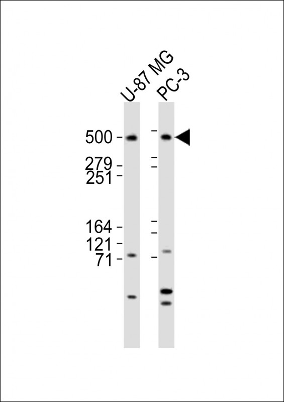 DYNC1H1 Antibody - All lanes : Anti-DYNC1H1 Antibody at 1:2000 dilution Lane 1: U-87 MG whole cell lysates Lane 2: PC-3 whole cell lysates Lysates/proteins at 20 ug per lane. Secondary Goat Anti-Rabbit IgG, (H+L), Peroxidase conjugated at 1/10000 dilution Predicted band size : 532 kDa Blocking/Dilution buffer: 5% NFDM/TBST.