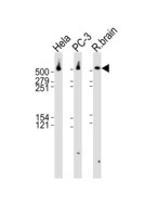 DYNC1H1 Antibody - Western blot of lysates from HeLa, PC-3 cell line and rat brain tissue lysate (from left to right) with DYNC1H1 Antibody. Antibody was diluted at 1:1000 at each lane. A goat anti-rabbit IgG H&L (HRP) at 1:10000 dilution was used as the secondary antibody. Lysates at 35 ug per lane.