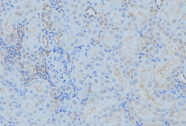 DYNC1H1 Antibody - 1:100 staining mouse kidney tissue by IHC-P. The sample was formaldehyde fixed and a heat mediated antigen retrieval step in citrate buffer was performed. The sample was then blocked and incubated with the antibody for 1.5 hours at 22°C. An HRP conjugated goat anti-rabbit antibody was used as the secondary.