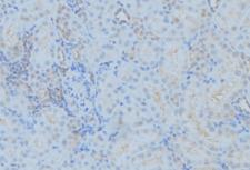 DYNC1H1 Antibody - 1:100 staining mouse kidney tissue by IHC-P. The sample was formaldehyde fixed and a heat mediated antigen retrieval step in citrate buffer was performed. The sample was then blocked and incubated with the antibody for 1.5 hours at 22°C. An HRP conjugated goat anti-rabbit antibody was used as the secondary.