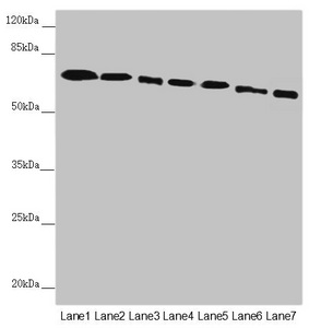DYNC1I1 Antibody - Western blot All Lanes:DYNC1I1 antibody at 2.52 ug/ml Lane 1: Mouse brain tissue Lane 2: Mouse gonadal tissue Lane 3: K562 whole cell lysate Lane 4: HL60 whole cell lysate Lane 5: Mouse lung tissue Lane 6: Mouse skeletal muscle tissue Lane 7: Mouse stomach tissue Secondary Goat polyclonal to rabbit IgG at 1/10000 dilution Predicted band size: 73,71,69,68 kDa Observed band size: 73 kDa
