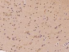 DYNC1I1 Antibody - Immunochemical staining of human DYNC1I1 in human brain with rabbit polyclonal antibody at 1:100 dilution, formalin-fixed paraffin embedded sections.