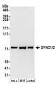 DYNC1I2 / IC2 Antibody - Detection of human DYNC1I2 by western blot. Samples: Whole cell lysate (50 µg) from HeLa, HEK293T, and Jurkat cells prepared using NETN lysis buffer. Antibodies: Affinity purified rabbit anti-DYNC1I2 antibody used for WB at 0.1 µg/ml. Detection: Chemiluminescence with an exposure time of 30 seconds.