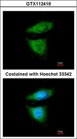 DYNC1I2 / IC2 Antibody - Immunofluorescence of methanol-fixed HeLa using DYNC1I2 antibody at 1:200 dilution.