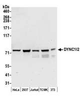 DYNC1I2 / IC2 Antibody - Detection of human and mouse DYNC1I2 by western blot. Samples: Whole cell lysate (50 µg) from HeLa, HEK293T, Jurkat, mouse TCMK-1, and mouse NIH 3T3 cells prepared using NETN lysis buffer. Antibodies: Affinity purified rabbit anti-DYNC1I2 antibody used for WB at 0.1 µg/ml. Detection: Chemiluminescence with an exposure time of 30 seconds.
