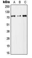 DYNC1I2 / IC2 Antibody - Western blot analysis of DYNC1I2 expression in HEK293T (A); Raw264.7 (B); H9C2 (C) whole cell lysates.
