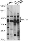 DYNC1I2 / IC2 Antibody - Western blot analysis of extracts of various cell lines, using DYNC1I2 antibody at 1:1000 dilution. The secondary antibody used was an HRP Goat Anti-Rabbit IgG (H+L) at 1:10000 dilution. Lysates were loaded 25ug per lane and 3% nonfat dry milk in TBST was used for blocking. An ECL Kit was used for detection and the exposure time was 1s.