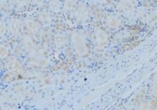 DYNC1I2 / IC2 Antibody - 1:100 staining mouse kidney tissue by IHC-P. The sample was formaldehyde fixed and a heat mediated antigen retrieval step in citrate buffer was performed. The sample was then blocked and incubated with the antibody for 1.5 hours at 22°C. An HRP conjugated goat anti-rabbit antibody was used as the secondary.