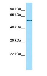 DYNC1LI1 Antibody - DYNC1LI1 antibody Western Blot of Jurkat.  This image was taken for the unconjugated form of this product. Other forms have not been tested.