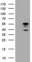DYNC1LI1 Antibody - HEK293T cells were transfected with the pCMV6-ENTRY control (Left lane) or pCMV6-ENTRY DYNC1LI1 (Right lane) cDNA for 48 hrs and lysed. Equivalent amounts of cell lysates (5 ug per lane) were separated by SDS-PAGE and immunoblotted with anti-DYNC1LI1.