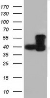 DYNC1LI1 Antibody - HEK293T cells were transfected with the pCMV6-ENTRY control (Left lane) or pCMV6-ENTRY DYNC1LI1 (Right lane) cDNA for 48 hrs and lysed. Equivalent amounts of cell lysates (5 ug per lane) were separated by SDS-PAGE and immunoblotted with anti-DYNC1LI1.