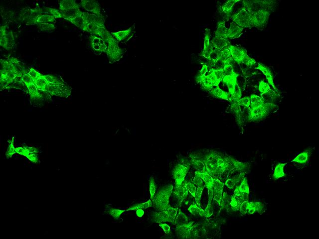 DYNC1LI1 Antibody - Immunofluorescence staining of DYNC1LI1 in A431 cells. Cells were fixed with 4% PFA, permeabilzed with 0.1% Triton X-100 in PBS, blocked with 10% serum, and incubated with rabbit anti-Human DYNC1LI1 polyclonal antibody (dilution ratio 1:200) at 4°C overnight. Then cells were stained with the Alexa Fluor 488-conjugated Goat Anti-rabbit IgG secondary antibody (green). Positive staining was localized to Cytoplasm.