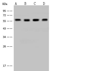 DYNC1LI1 Antibody - Anti-DYNC1LI1 rabbit polyclonal antibody at 1:500 dilution. Lane A: K562 Whole Cell Lysate. Lane B: HeLa Whole Cell Lysate. Lane C: Jurkat Whole Cell Lysate. Lane D: 293T Whole Cell Lysate. Lysates/proteins at 30 ug per lane. Secondary: Goat Anti-Rabbit IgG (H+L)/HRP at 1/10000 dilution. Developed using the ECL technique. Performed under reducing conditions. Predicted band size: 57 kDa. Observed band size: 57 kDa.