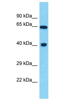 DYNC1LI2 Antibody - DYNC1LI2 antibody Western Blot of COLO205. Antibody dilution: 1 ug/ml.  This image was taken for the unconjugated form of this product. Other forms have not been tested.