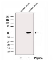 DYNC1LI2 Antibody - Western blot analysis of extracts of HuvEc cells using DYNC1LI2 antibody. The lane on the left was treated with blocking peptide.