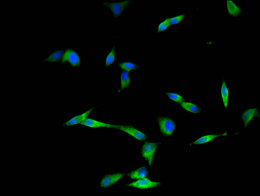 DYNC2H1 Antibody - Immunofluorescent analysis of Hela cells using DYNC2H1 Antibody at a dilution of 1:100 and Alexa Fluor 488-congugated AffiniPure Goat Anti-Rabbit IgG(H+L)