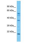 DYNC2LI1 / D2LIC Antibody - DYNC2LI1 / D2LIC antibody Western Blot of Fetal Kidney. Antibody dilution: 1 ug/ml.  This image was taken for the unconjugated form of this product. Other forms have not been tested.