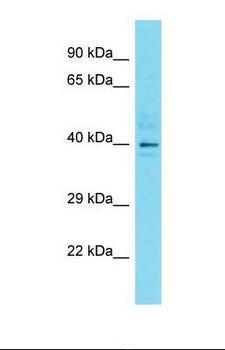 DYNC2LI1 / D2LIC Antibody - Western blot of Jurkat. DYNC2LI1 antibody dilution 1.0 ug/ml.  This image was taken for the unconjugated form of this product. Other forms have not been tested.