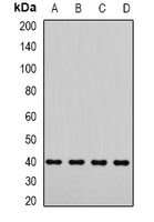 DYNC2LI1 / D2LIC Antibody - Western blot analysis of LIC3 expression in Jurkat (A); A549 (B); mouse testis (C); rat testis (D) whole cell lysates.