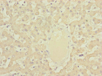 DYNC2LI1 / D2LIC Antibody - Immunohistochemistry of paraffin-embedded human liver tissue at dilution of 1:100