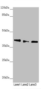 DYNC2LI1 / D2LIC Antibody - Western blot All Lanes:DYNC2LI1 antibody at 1.17 ug/ml Lane 1: 293T whole cell lysate Lane 2: A549 whole cell lysate Lane 3: Mouse gonadal tissue Secondary Goat polyclonal to rabbit IgG at 1/10000 dilution Predicted band size: 40,38,23,16 kDa Observed band size: 40 kDa