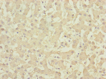 DYNC2LI1 / D2LIC Antibody - Immunohistochemistry of paraffin-embedded human liver tissue at dilution of 1:100