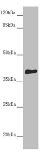 DYNC2LI1 / D2LIC Antibody - Western blot All Lanes:DYNC2LI1 antibody at 1.06 ug/ml+ Mouse gonadal tissue Secondary Goat polyclonal to rabbit IgG at 1/10000 dilution Predicted band size: 40,38,23,16 kDa Observed band size: 40 kDa