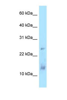 DYNLL1 / PIN Antibody - DYNLL1 antibody Western blot of Jurkat Cell lysate. Antibody concentration 1 ug/ml.  This image was taken for the unconjugated form of this product. Other forms have not been tested.
