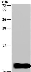 DYNLL1 / PIN Antibody - Western blot analysis of Mouse brain tissue, using DYNLL1 Polyclonal Antibody at dilution of 1:600.