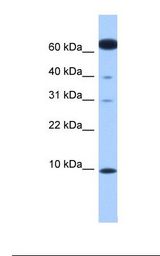 DYNLL1 / PIN Antibody - Fetal heart lysate. Antibody concentration: 1.0 ug/ml. Gel concentration: 10-20%.  This image was taken for the unconjugated form of this product. Other forms have not been tested.