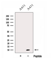 DYNLL2 Antibody - Western blot analysis of extracts of A431 cells using DYNLL2 antibody. The lane on the left was treated with blocking peptide.